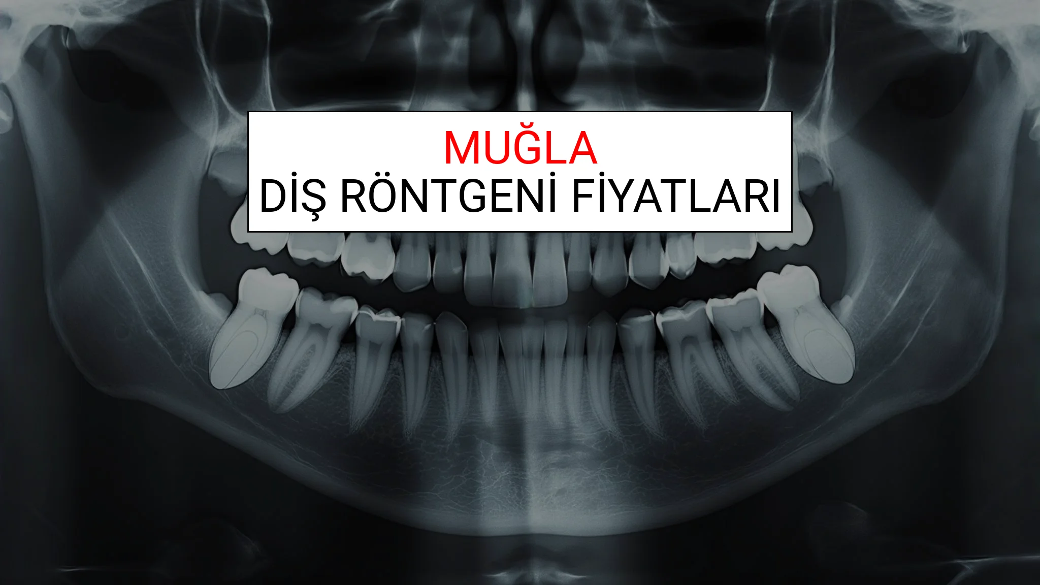 Muğla Diş Röntgeni (Periapikal) Fiyatları Ne Kadar? (2025 TDB Muğla Diş Röntgeni Ücreti)