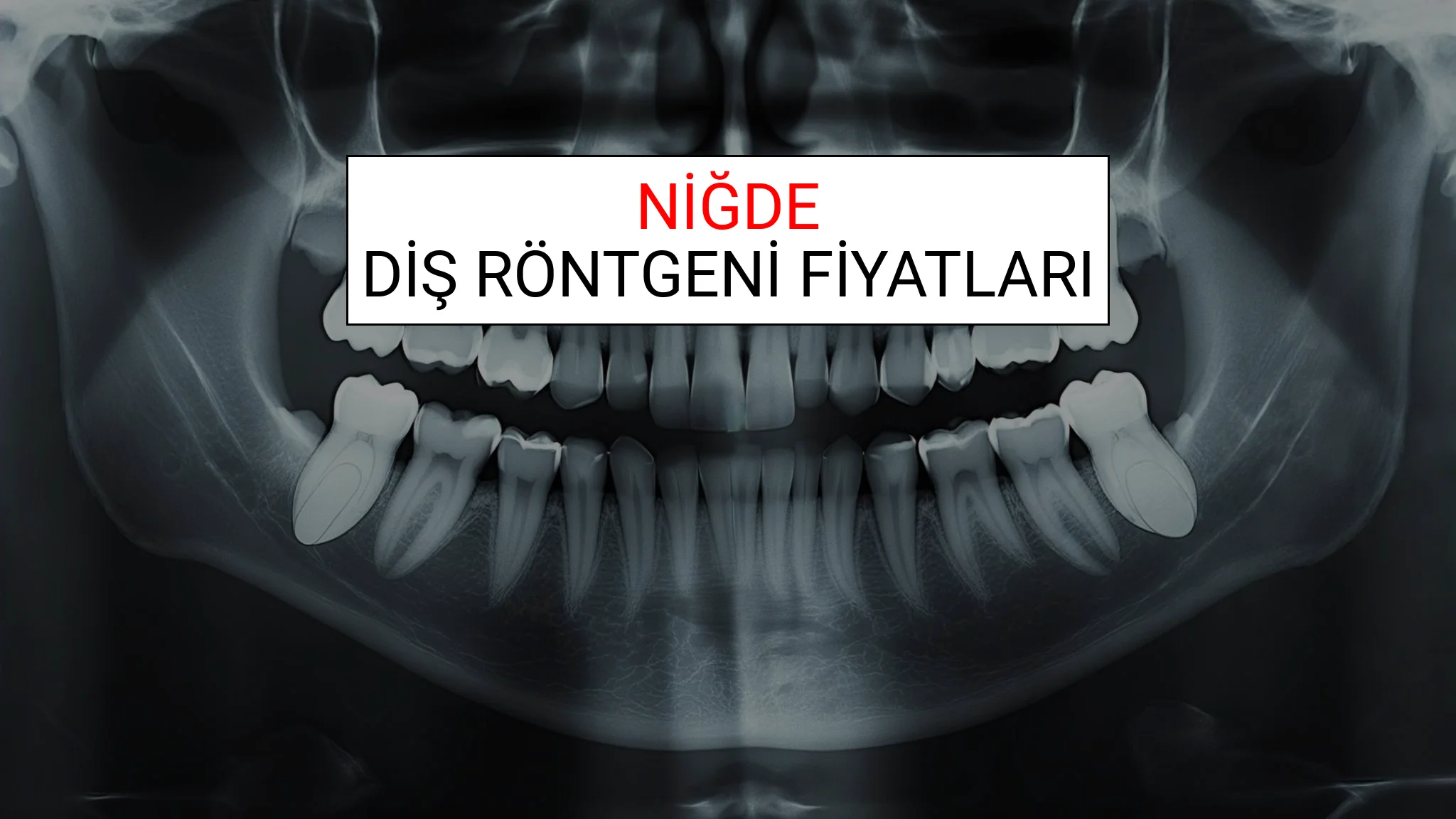 Niğde Diş Röntgeni (Periapikal) Fiyatları Ne Kadar? (2025 TDB Niğde Diş Röntgeni Ücreti)