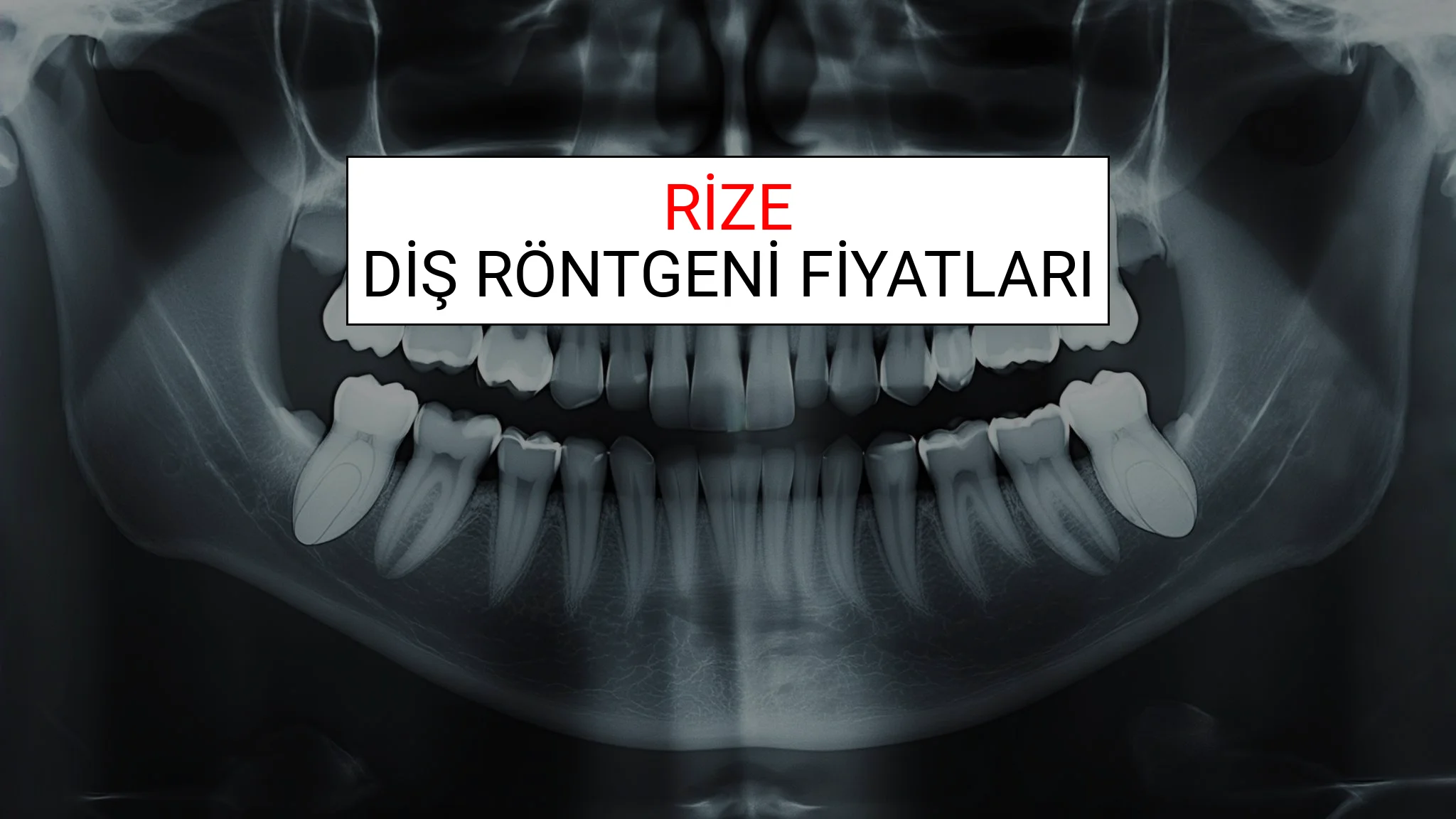Rize Diş Röntgeni (Periapikal) Fiyatları Ne Kadar? (2025 TDB Rize Diş Röntgeni Ücreti)
