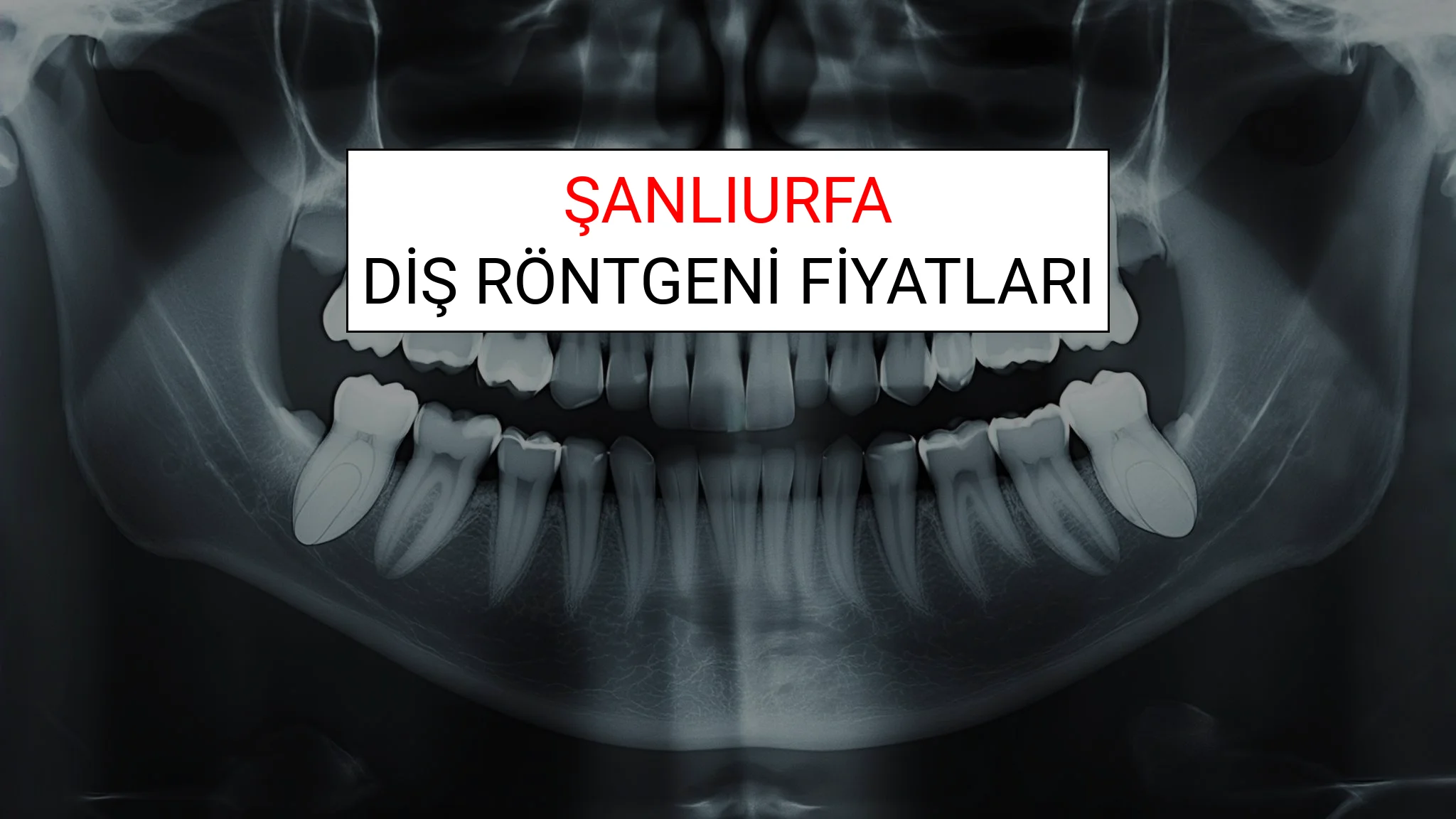 Şanlıurfa Diş Röntgeni (Periapikal) Fiyatları Ne Kadar? (2025 TDB Şanlıurfa Diş Röntgeni Ücreti)