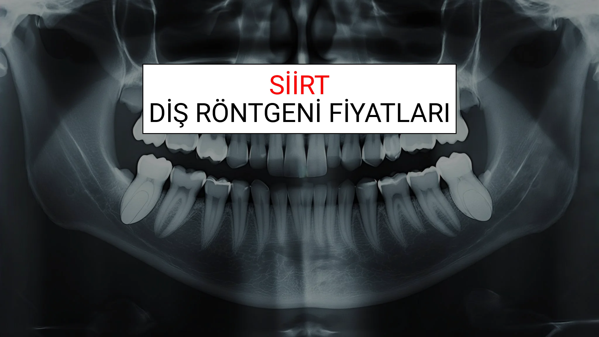 Siirt Diş Röntgeni (Periapikal) Fiyatları Ne Kadar? (2025 TDB Siirt Diş Röntgeni Ücreti)