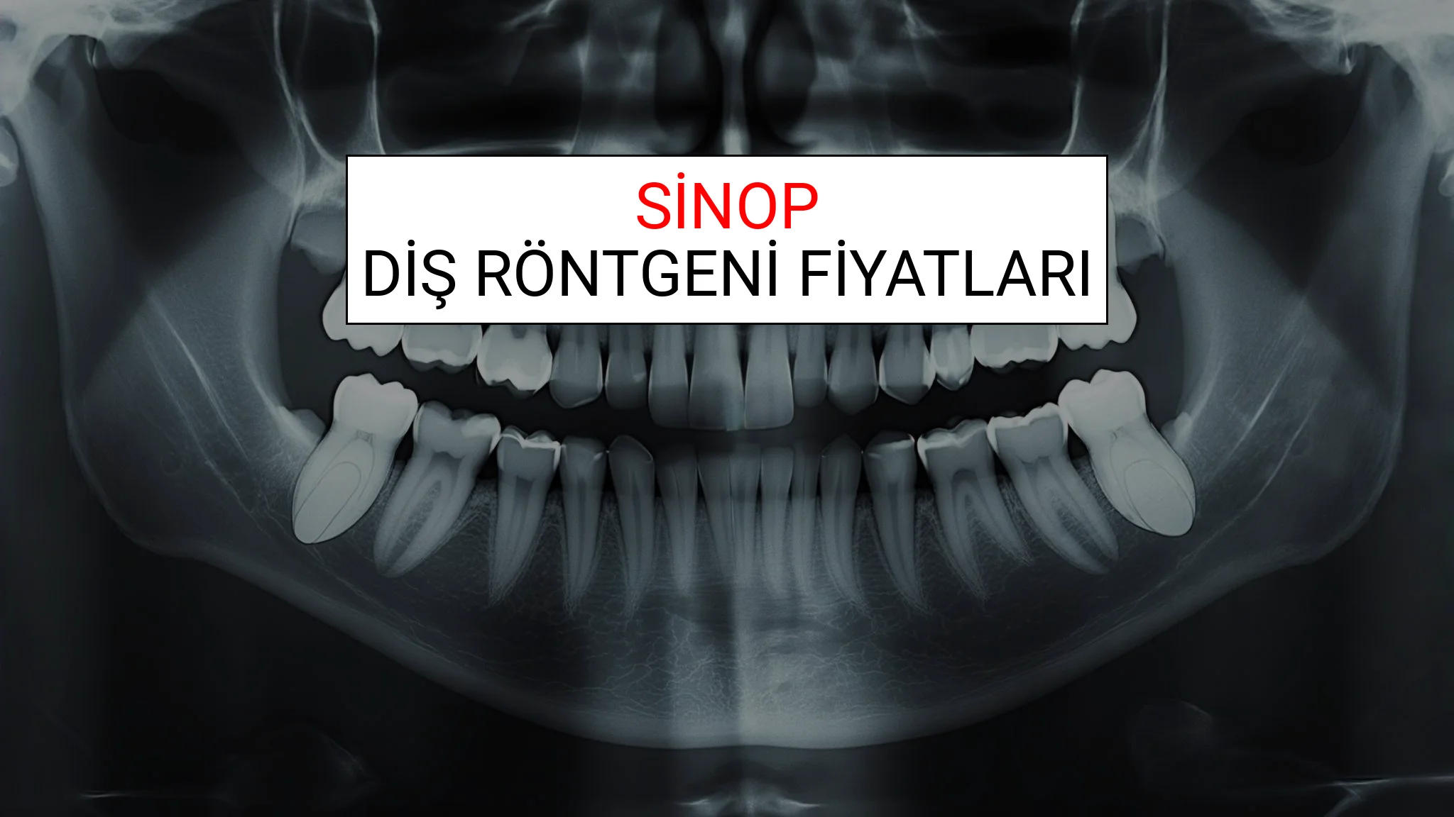 Sinop Diş Röntgeni (Periapikal) Fiyatları Ne Kadar? (2025 TDB Sinop Diş Röntgeni Ücreti)