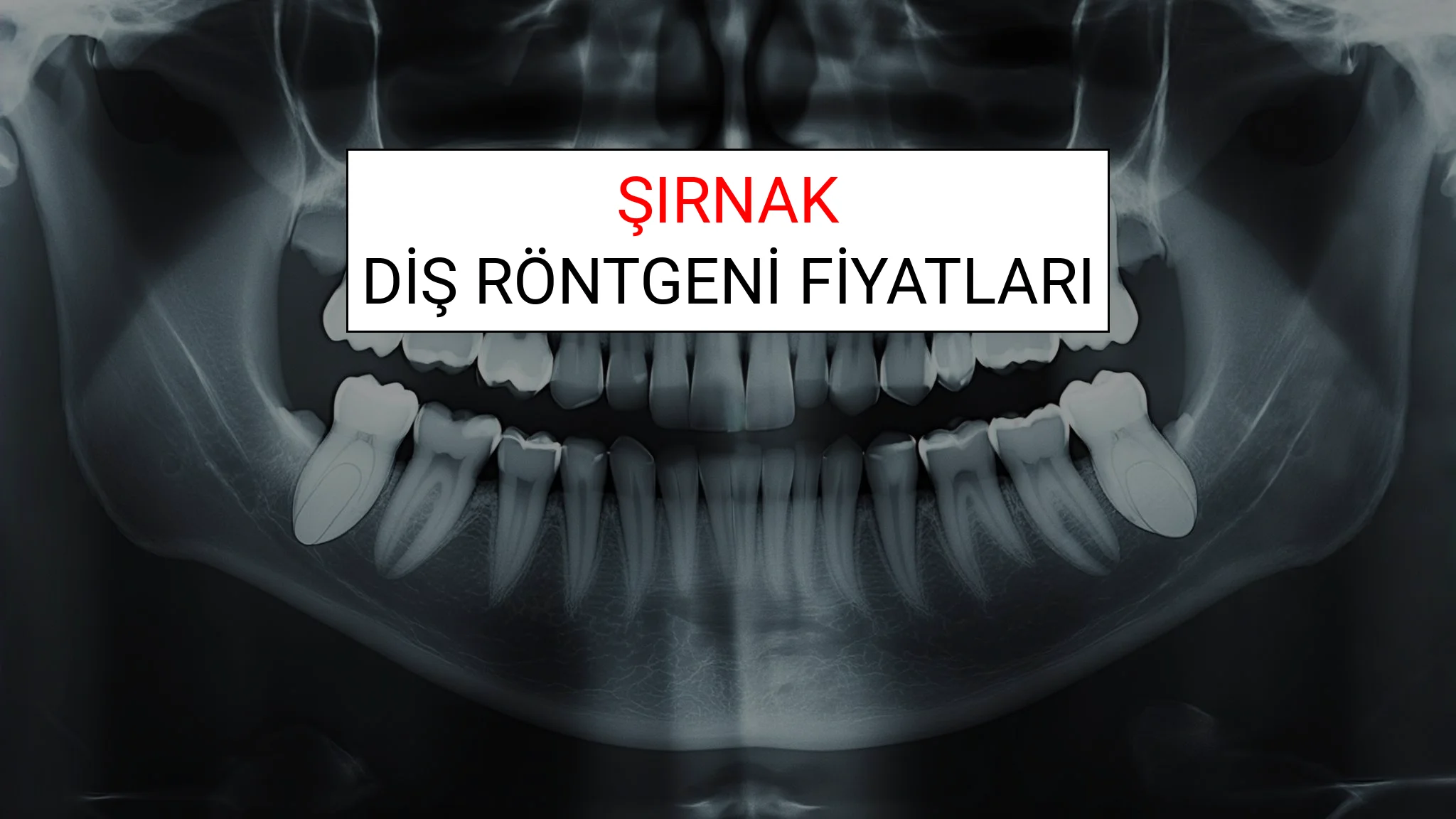 Şırnak Diş Röntgeni (Periapikal) Fiyatları Ne Kadar? (2025 TDB Şırnak Diş Röntgeni Ücreti)