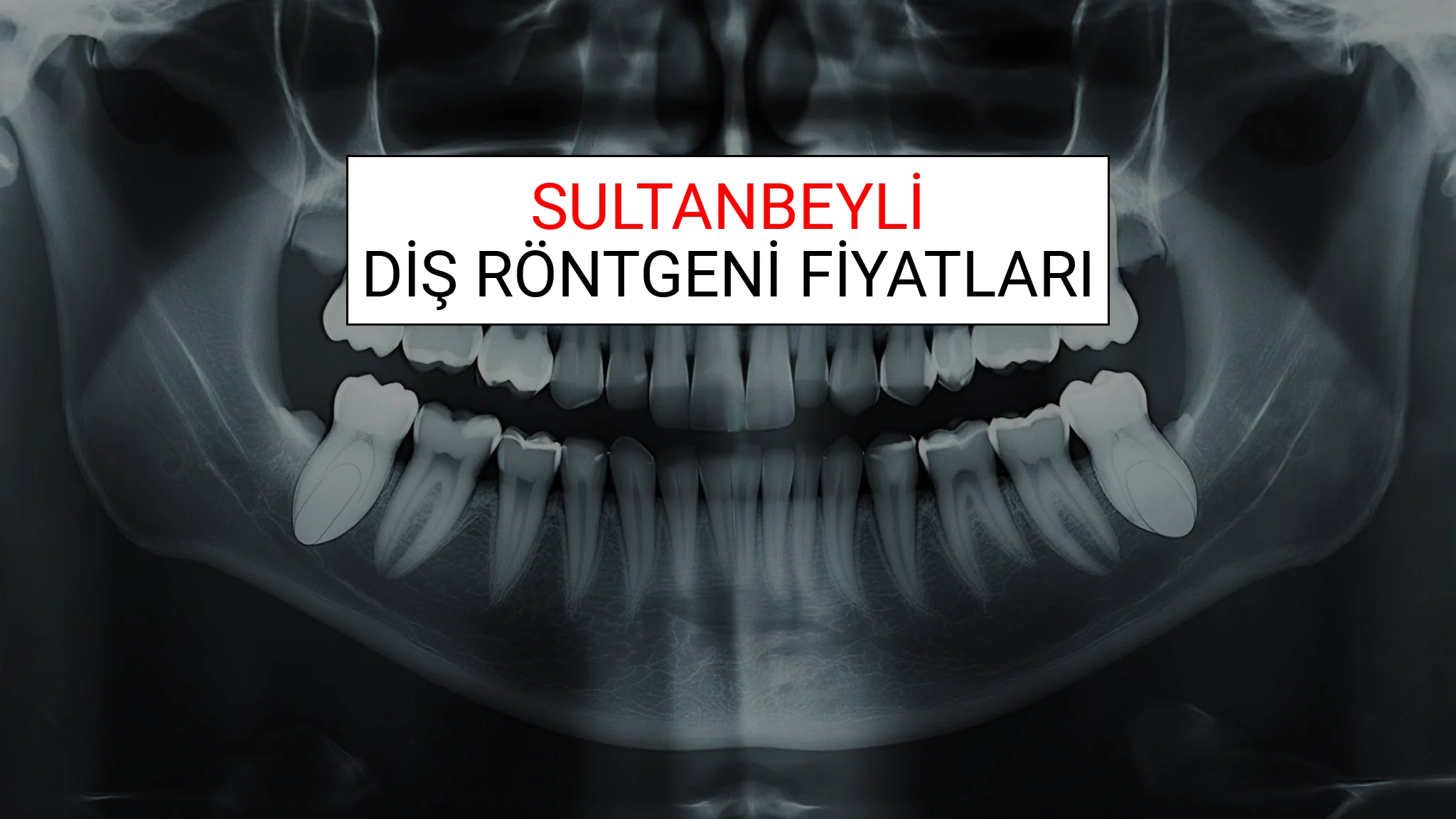 Sultanbeyli Diş Röntgeni (Periapikal) Fiyatları Ne Kadar? (2025 TDB Sultanbeyli Diş Röntgeni Ücreti)