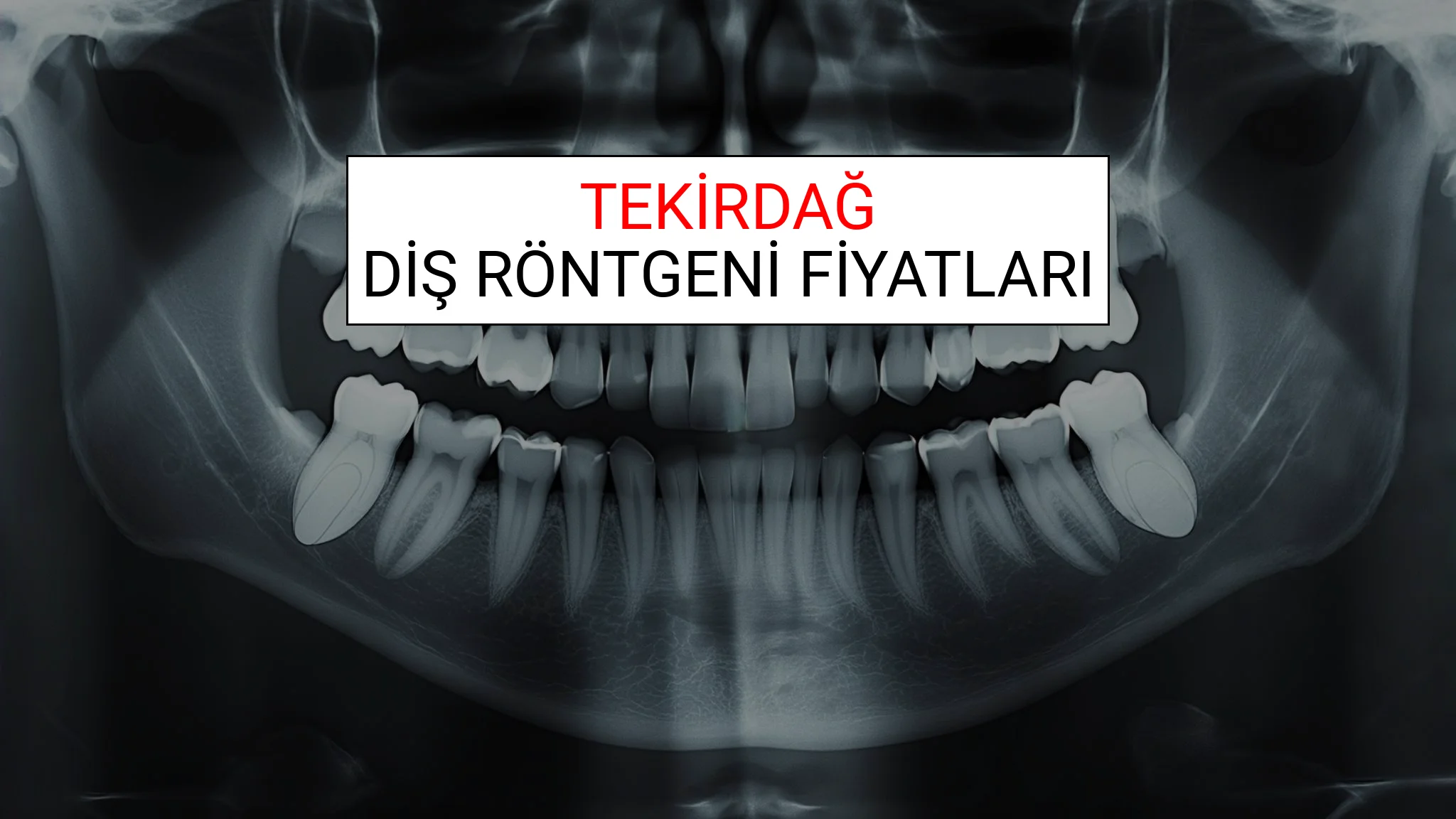 Tekirdağ Diş Röntgeni (Periapikal) Fiyatları Ne Kadar? (2025 TDB Tekirdağ Diş Röntgeni Ücreti)