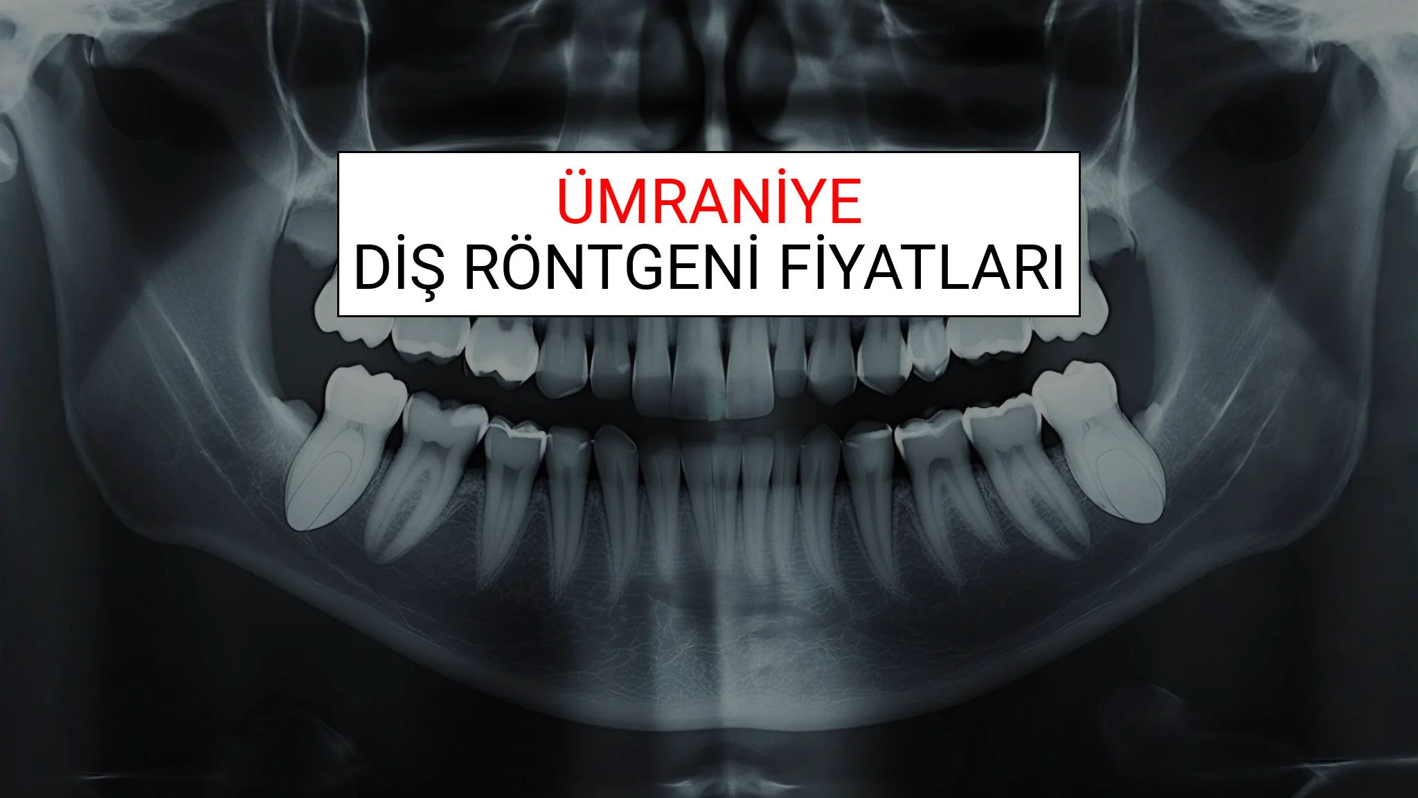 Ümraniye Diş Röntgeni (Periapikal) Fiyatları Ne Kadar? (2025 TDB Ümraniye Diş Röntgeni Ücreti)