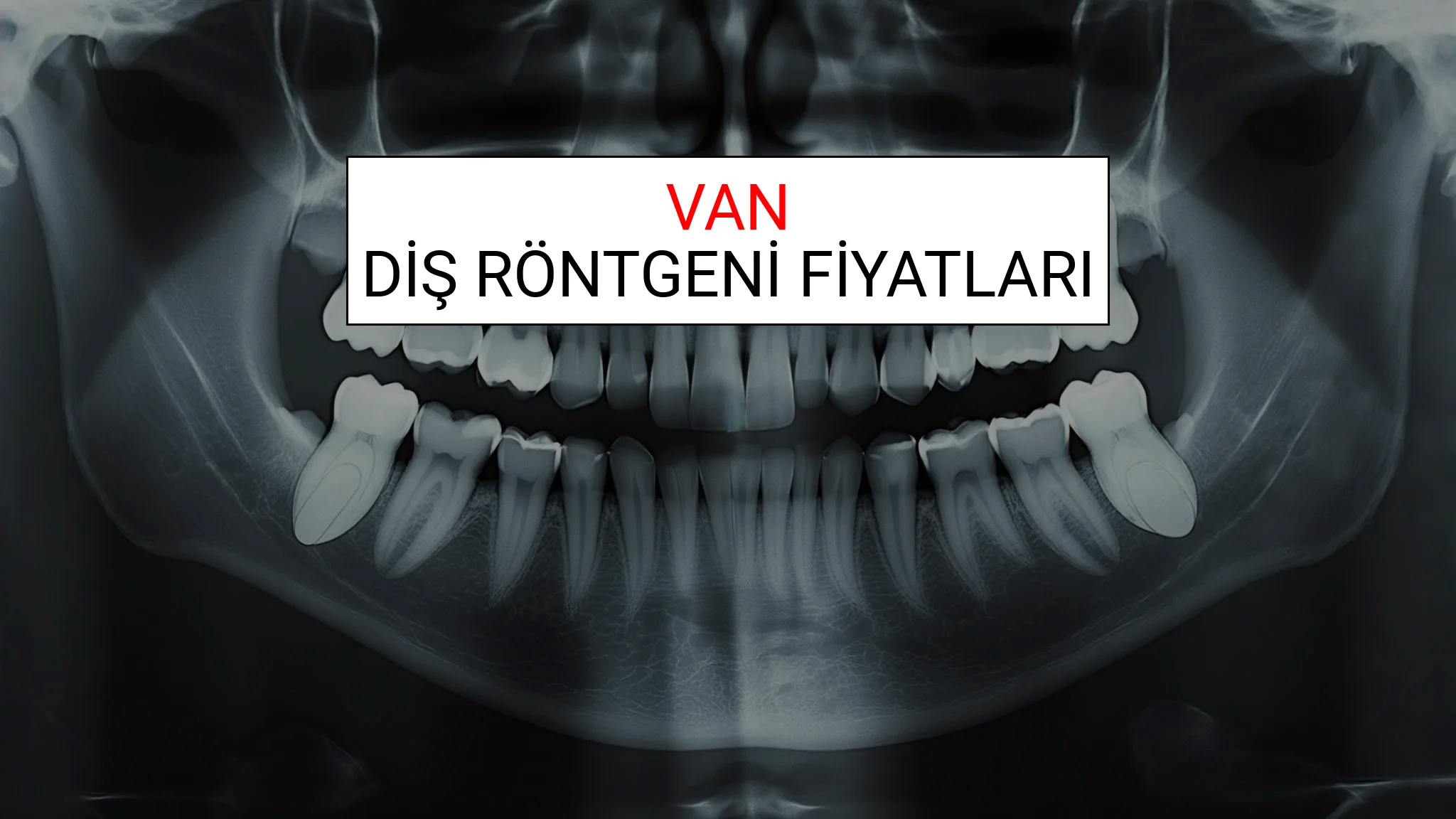 Van Diş Röntgeni (Periapikal) Fiyatları Ne Kadar? (2025 TDB Van Diş Röntgeni Ücreti)